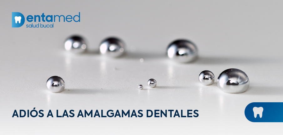 Adiós a las amalgamas dentales